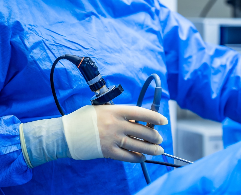 Exame de Endoscopia Digestiva Alta realizado pela Dra. Mariana Hassan